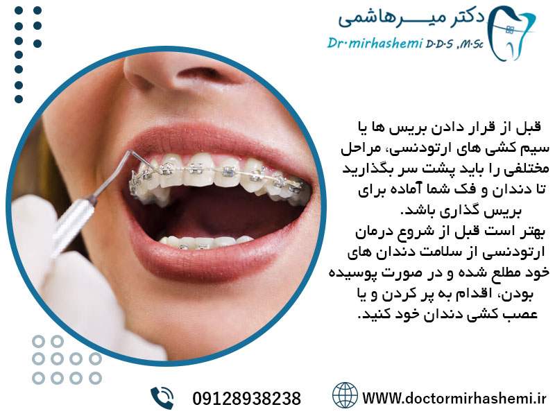 معاینه دندان قبل از ارتودنسی