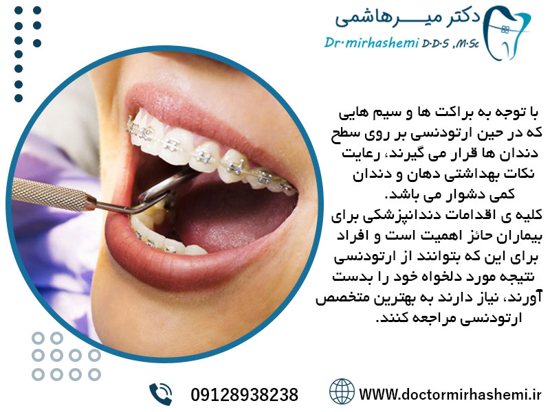 عصب کشی دندان در زمان ارتودنسی
