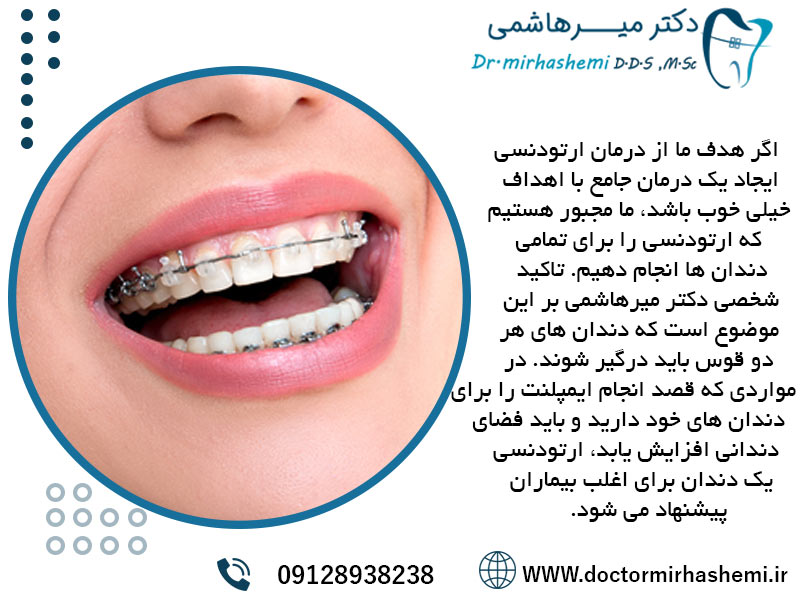 ارتودنسی تک دندان روشی برای از بین بردن ناهنجاری دندان