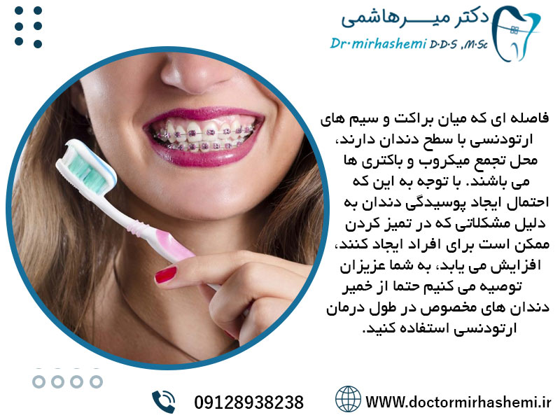 اهمیت استفاده از خمیر دندان در ارتودنسی